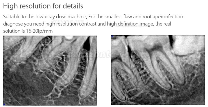 Handy HDR-600 Sensor Para Radiografia Odontológica Sistema de Imagem por Raio-x Intraoral